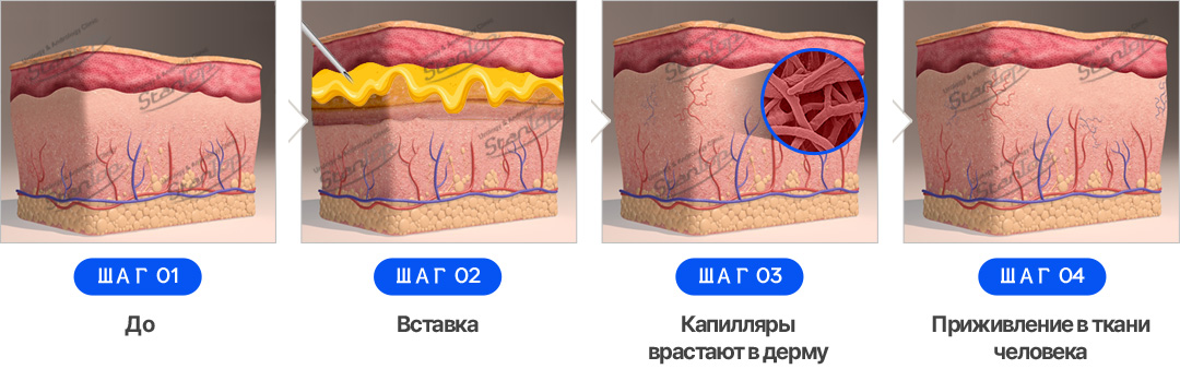 inner_about-image